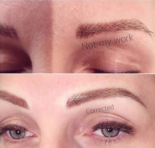 Brow Correction